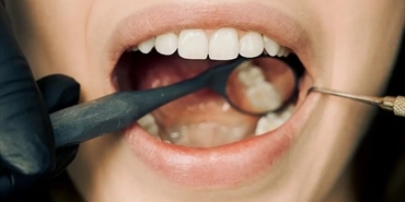 4 علامات تنذر بخطر سرطان الفم